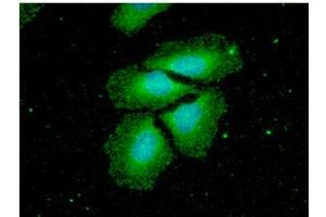 ICC/IF analysis of NME2 in HeLa cells.