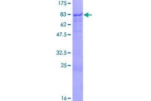 Image no. 1 for SRY (Sex Determining Region Y)-Box 10 (SOX10) (AA 1-466) protein (GST tag) (ABIN1320978)