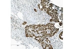 IHC analysis of PTBP2 using anti-PTBP2 antibody (ABIN7599453). (PTBP2 anticorps  (AA 1-504))