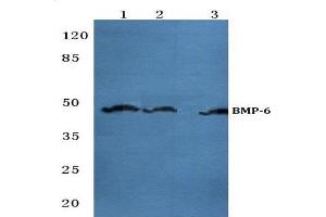 Western blot (WB) analysis of BMP-6 antibody  at 1/500 dilution. (BMP6 anticorps)