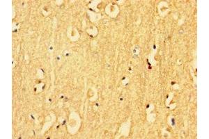 Immunohistochemistry of paraffin-embedded human brain tissue using ABIN7157217 at dilution of 1:100