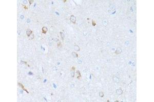 Immunohistochemistry of paraffin-embedded Rat brain using SERPINA3 Polyclonal Antibody at dilution of 1:100 (40x lens). (SERPINA3 anticorps)