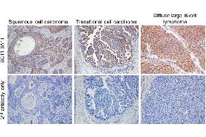 Immunohistochemistryof dog tumor tissues Formalin-fixed and paraffin-embedded tissue sections of dog cancers,including squamous cell carcinoma, transitional cell carcinoma,and diffuse large B-cell lymphoma,were sequentially treated with anti-PD-L1 antibody (6C11-3A11,5 g /mL)and with polymer type rat IgG secondary antibody-HRP conjugatedand visualized by 3, 3-diaminobenzidine (DAB) staining.