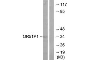 Western blot analysis of extracts from Jurkat cells, using OR51D1 Antibody. (OR51D1 anticorps  (AA 33-82))