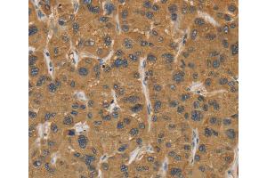 Immunohistochemistry (IHC) image for anti-Cytochrome P450, Family 17, Subfamily A, Polypeptide 1 (CYP17A1) antibody (ABIN2423242) (CYP17A1 anticorps)