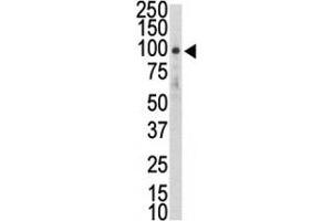 Western blot analysis of DDR2 antibody and HL-60 lysate.