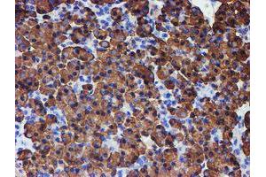 Image no. 7 for anti-Protein Disulfide Isomerase Family A, Member 4 (PDIA4) antibody (ABIN1500110)