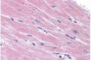 Human Heart: Formalin-Fixed, Paraffin-Embedded (FFPE)