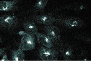 Immunofluorescence staining of human endothelial cells. (GGA2 anticorps  (AA 334-445))