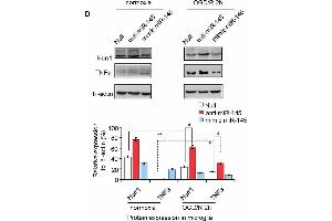 miR-145-5p regulates endogenous Nurr1 levels in microglia. (beta Actin anticorps)