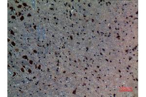Immunohistochemistry (IHC) analysis of paraffin-embedded Mouse Brain, antibody was diluted at 1:100.