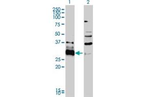 Western Blot analysis of HDGFRP3 expression in transfected 293T cell line by HDGFRP3 monoclonal antibody (M01), clone 2G12.