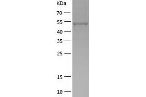 Western Blotting (WB) image for MNT, MAX Dimerization Protein (MNT) (AA 1-465) protein (His tag) (ABIN7124007) (MNT Protein (AA 1-465) (His tag))