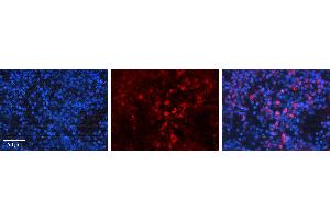 Rabbit Anti-BAK1 Antibody   Formalin Fixed Paraffin Embedded Tissue: Human Lymph Node Tissue Observed Staining: Cytoplasm Primary Antibody Concentration: 1:100 Other Working Concentrations: N/A Secondary Antibody: Donkey anti-Rabbit-Cy3 Secondary Antibody Concentration: 1:200 Magnification: 20X Exposure Time: 0.