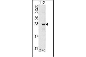 Image no. 1 for anti-GTPase NRas (NRAS) (C-Term) antibody (ABIN360039) (GTPase NRas anticorps  (C-Term))