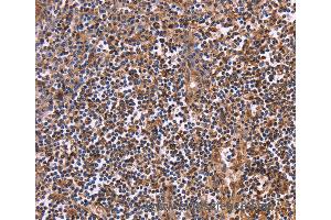Immunohistochemistry of Human tonsil using CLUAP1 Polyclonal Antibody at dilution of 1:50 (CLUAP1 anticorps)