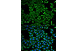 Immunofluorescence analysis of  cells using  antibody (ABIN6129646, ABIN6137275, ABIN6137276 and ABIN6220922). (ATL1 anticorps  (AA 1-280))