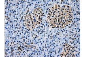 Immunohistochemical staining of paraffin-embedded Ovary tissue using anti-GBE1 mouse monoclonal antibody. (GBE1 anticorps)