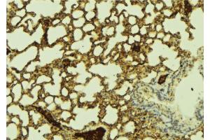 ABIN6274431 at 1/100 staining Mouse lung tissue by IHC-P. (PPHLN1 anticorps  (N-Term))