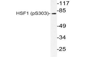 Western blot (WB) analyzes of p-HSF1 antibody in extracts from A549 PMA cells. (HSF1 anticorps  (pSer303))