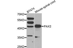 Western blot analysis of extracts of various cell lines, using PAX2 antibody (ABIN1874046) at 1:500 dilution. (PAX2A anticorps)