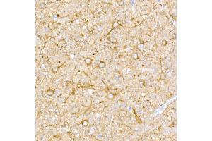 Immunohistochemistry of paraffin-embedded rat brain using NgR3 Rabbit mAb (ABIN7269932) at dilution of 1:50 (40x lens). (RTN4RL1 anticorps)