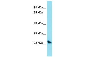 Western Blotting (WB) image for anti-Sclerostin Domain Containing 1 (SOSTDC1) (C-Term) antibody (ABIN2789781)
