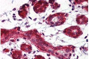 Human Breast (formalin-fixed, paraffin-embedded) stained with Heat Shock Protein 90 (HSP90) antibody ABIN364328 at 5 ug/ml followed by biotinylated anti-mouse IgG secondary antibody ABIN481714, alkaline phosphatase-streptavidin and chromogen. (HSP90 anticorps  (AA 1-732))