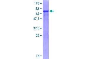 Image no. 1 for Isocitrate Dehydrogenase 1 (NADP+), Soluble (IDH1) (AA 1-414) protein (GST tag) (ABIN1307369)