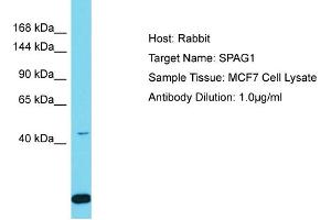 Host: Rabbit Target Name: SPAG1 Sample Tissue: Human MCF7 Whole Cell Antibody Dilution: 1ug/ml (SPAG1 anticorps  (N-Term))