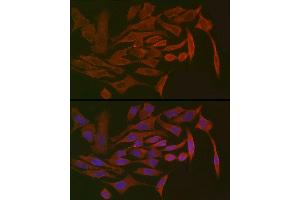 Immunofluorescence analysis of HeLa cells using PIGR Rabbit pAb (ABIN6128562, ABIN6145618, ABIN6145620 and ABIN6221728) at dilution of 1:150 (40x lens).