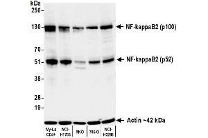 Western Blotting (WB) image for anti-NF-KappaB2 (/p52) (AA 1-50) antibody (ABIN7795782) (Recombinant NF-KappaB2 (/p52) (AA 1-50) anticorps)