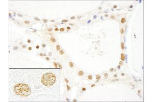 Immunohistochemistry (IHC) image for anti-LUC7-Like 3 (LUC7L3) (AA 1-50) antibody (ABIN7448489) (LUC7-Like 3 anticorps  (AA 1-50))
