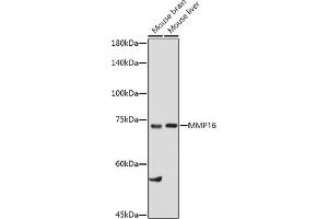 Western blot analysis of extracts of various cell lines, using MMP16 antibody (ABIN6132356, ABIN6143906, ABIN6143907 and ABIN6214654) at 1:1000 dilution. (MMP16 anticorps  (AA 290-565))