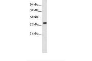 Image no. 1 for anti-Zinc Finger Protein 2 (ZNF2) (AA 124-173) antibody (ABIN202176)