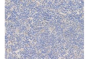 ABIN7095687 and ABIN7099749 at 1/100 staining human normal tonsil tissue by IHC-P. (FEZF2 anticorps)