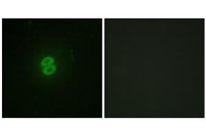 Immunofluorescence analysis of A549 cells, using CD253 antibody. (TRAIL anticorps  (Internal Region))
