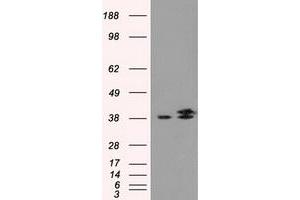 HEK293T cells were transfected with the pCMV6-ENTRY control (Left lane) or pCMV6-ENTRY IDH3A (Right lane) cDNA for 48 hrs and lysed.