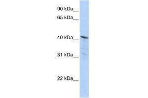 WB Suggested Anti-HDAC11 Antibody Titration:  0. (HDAC11 anticorps  (Middle Region))