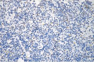 anti-MAD2 Mitotic Arrest Deficient-Like 2 (MAD2L2) antibody