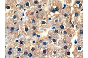 Detection of GSTa3 in Rat Liver Tissue using Polyclonal Antibody to Glutathione S Transferase Alpha 3 (GSTa3)