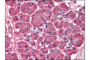 Image no. 1 for anti-SKI Proto-Oncogene (SKI) (N-Term) antibody (ABIN303247) (SKI anticorps  (N-Term))