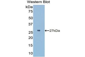 Western Blotting (WB) image for anti-HLA Class II DR alpha (HLA-DRA) (AA 28-232) antibody (ABIN1175589) (HLA-DRA anticorps  (AA 28-232))