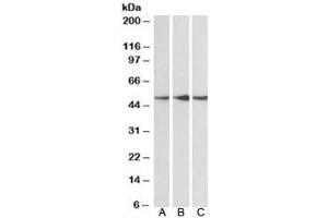 Western blot testing of human cerebellum [A], mouse [B] and rat [C] brain lysate with PPP2R5E antibody at 0. (PPP2R5E anticorps)