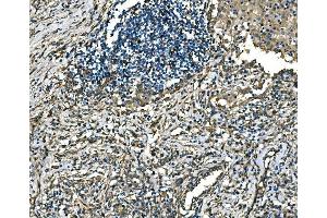 IHC analysis of RAB13 using anti-RAB13 antibody (ABIN7600599). (RAB13 anticorps  (AA 21-200))