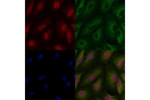 ABIN6257418 and ABIN6273806 staining  cells by IF/ICC. (PKC iota anticorps  (Internal Region))