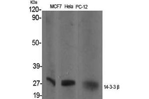 Western Blot (WB) analysis of specific cells using 14-3-3 beta Polyclonal Antibody. (YWHAB anticorps  (Internal Region))