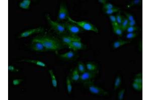 Immunofluorescence staining of Hela cells with ABIN7147596 at 1:100, counter-stained with DAPI. (CCKAR anticorps  (AA 235-313))