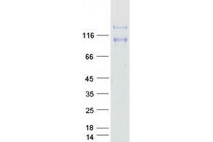 Validation with Western Blot