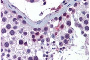 Human Testis: Formalin-Fixed, Paraffin-Embedded (FFPE)